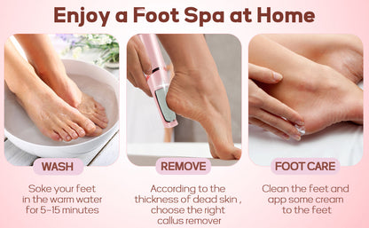 Professional Callus Filer and Foot Scrubber Kit for Silky Smooth Feet -Includes Pedicure Tools for Women