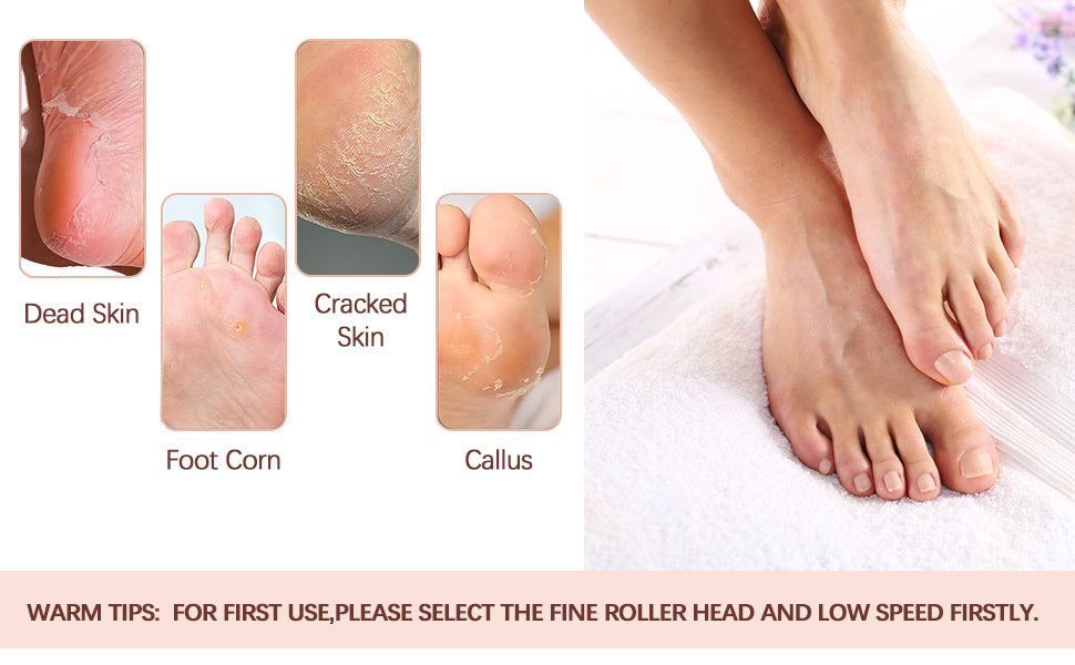 Professional Callus Filer and Foot Scrubber Kit for Silky Smooth Feet -Includes Pedicure Tools for Women